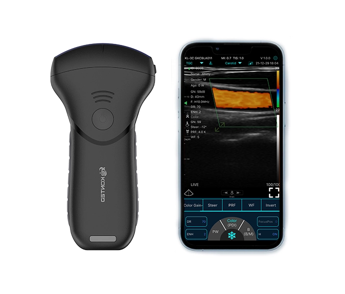 C10MT PRO Pocket Ultrasound Scanner USB&WiFi