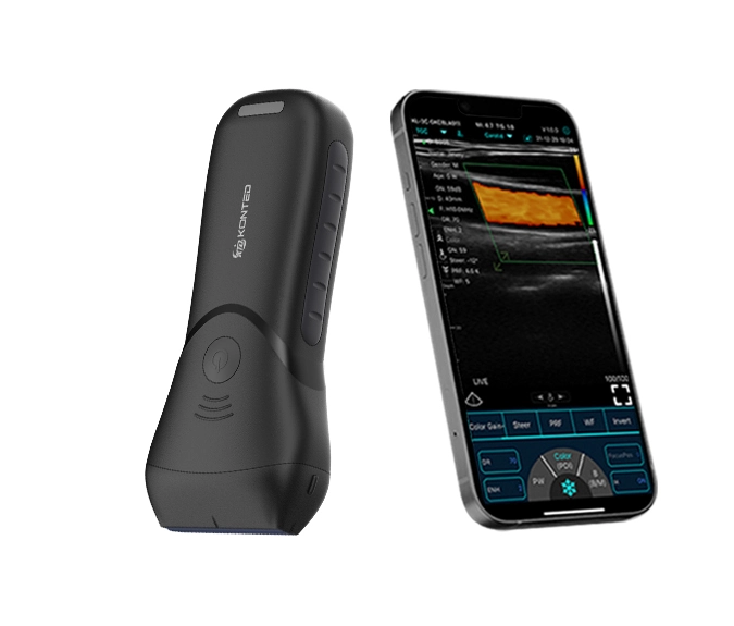 C10MX PRO Pocket Ultrasound USB&WiFi